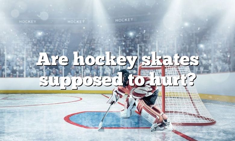 Are hockey skates supposed to hurt?