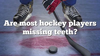 Are most hockey players missing teeth?