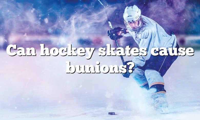 Can hockey skates cause bunions?