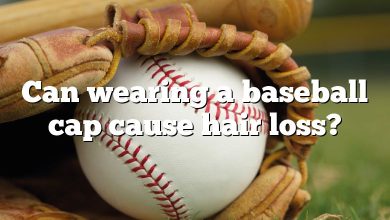 Can wearing a baseball cap cause hair loss?