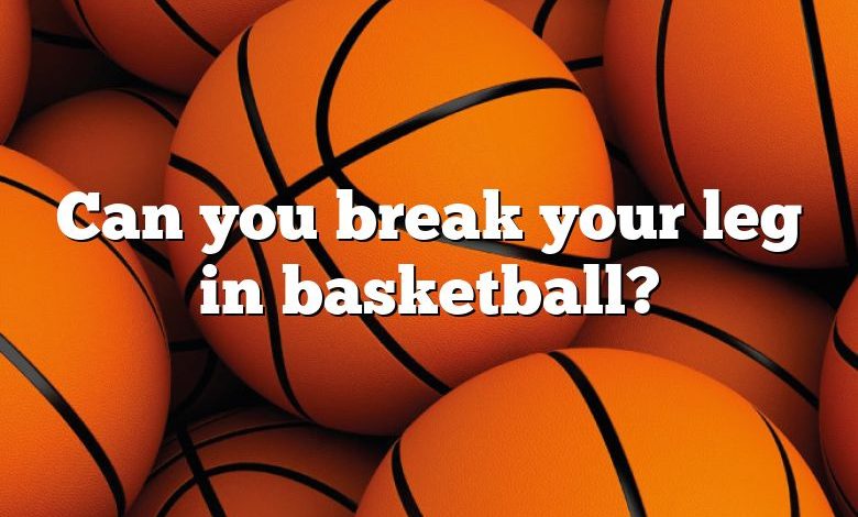 Can you break your leg in basketball?