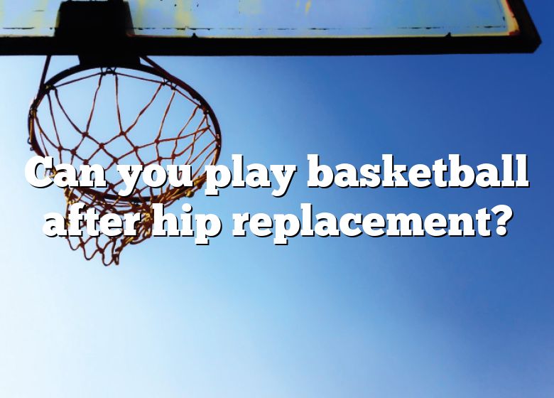  Can You Play Basketball After Hip Replacement DNA Of SPORTS