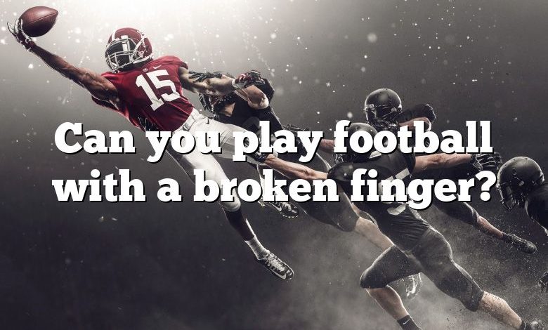 Can you play football with a broken finger?