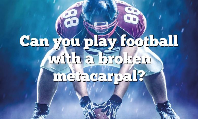 Can you play football with a broken metacarpal?