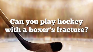 Can you play hockey with a boxer’s fracture?