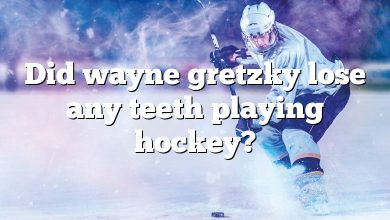 Did wayne gretzky lose any teeth playing hockey?