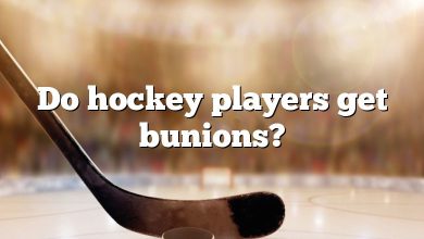 Do hockey players get bunions?