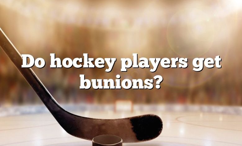 Do hockey players get bunions?