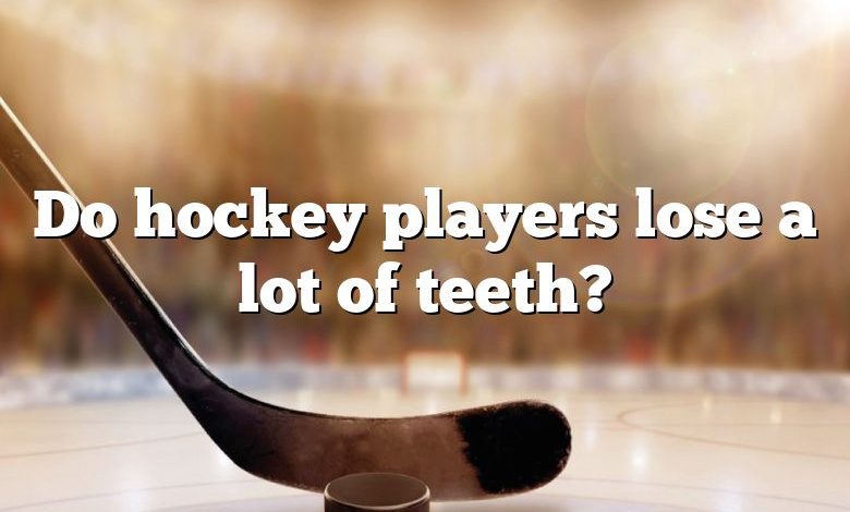 Do hockey players lose a lot of teeth?