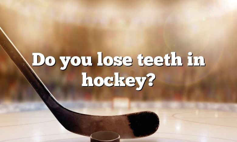 Do you lose teeth in hockey?