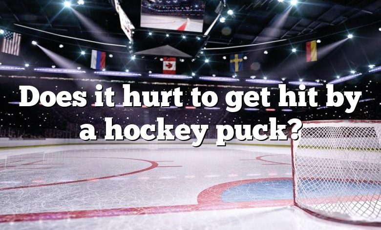 Does it hurt to get hit by a hockey puck?