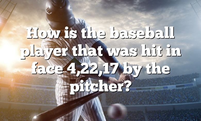 How is the baseball player that was hit in face 4,22,17 by the pitcher?