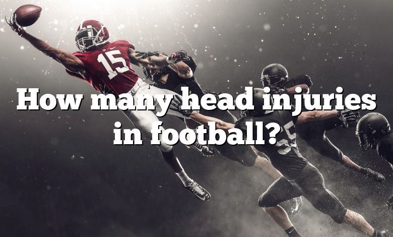 How many head injuries in football?