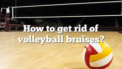 How to get rid of volleyball bruises?