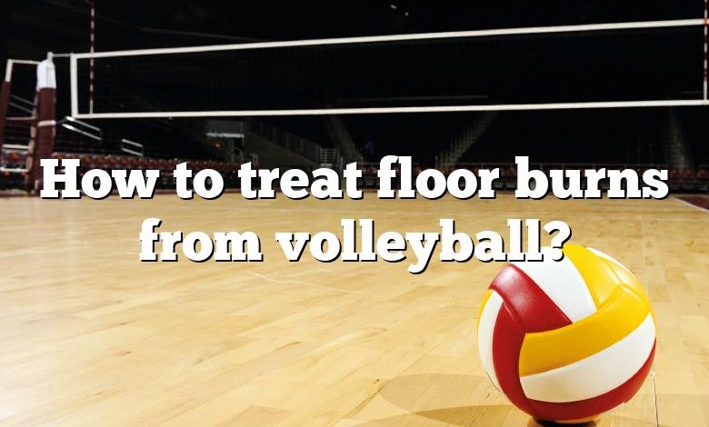 How to treat floor burns from volleyball?