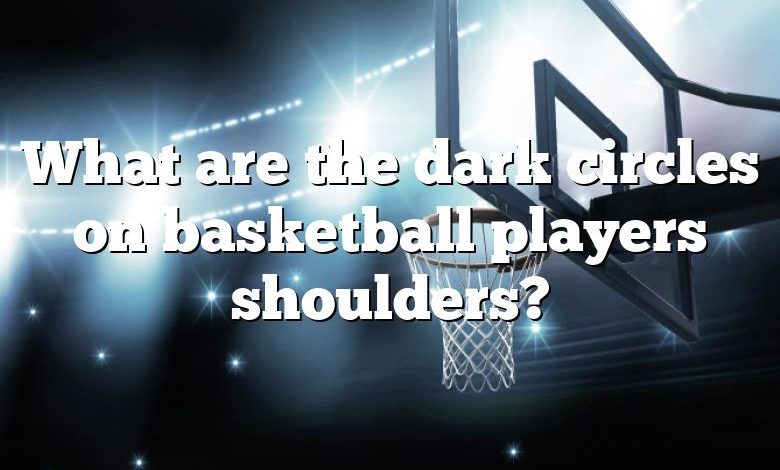 What are the dark circles on basketball players shoulders?