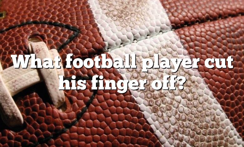 What football player cut his finger off?