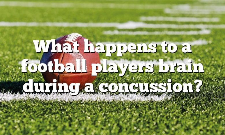 What happens to a football players brain during a concussion?