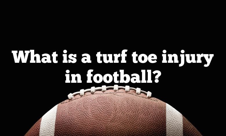 What is a turf toe injury in football?